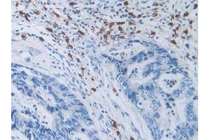 Immunohistochemistry (IHC) image for anti-Solute Carrier Family 12 (Sodium/Chloride Transporters), Member 3 (SLC12A3) (AA 3-146) antibody (ABIN7435784)