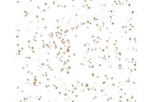 Immunocytochemistry (ICC) image for anti-SWI/SNF Related, Matrix Associated, Actin Dependent Regulator of Chromatin, Subfamily E, Member 1 (SMARCE1) (C-Term) antibody (ABIN7795731)
