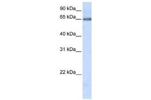 Western Blotting (WB) image for anti-DNA Cross-Link Repair 1C (DCLRE1C) antibody (ABIN2459466) (DCLRE1C 抗体)