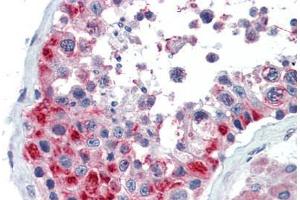 Human Testis (formalin-fixed, paraffin-embedded) stained with GSC antibody ABIN462175 followed by biotinylated goat anti-rabbit IgG secondary antibody ABIN481713, alkaline phosphatase-streptavidin and chromogen. (GSC 抗体  (AA 35-84))