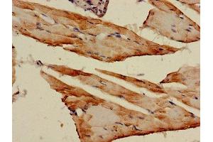 Immunohistochemistry of paraffin-embedded human skeletal muscle tissue using ABIN7143343 at dilution of 1:100 (Adenylate Kinase 1 抗体  (AA 1-194))