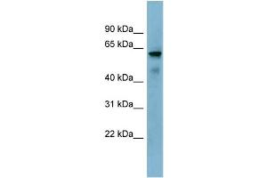 WB Suggested Anti-KIAA1627 Antibody Titration:  0. (KIAA1627 抗体  (N-Term))