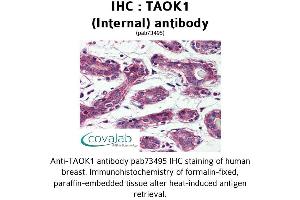 Image no. 1 for anti-TAO Kinase 1 (TAOK1) (Internal Region) antibody (ABIN1739900) (TAO Kinase 1 (TAOK1) (Internal Region) 抗体)