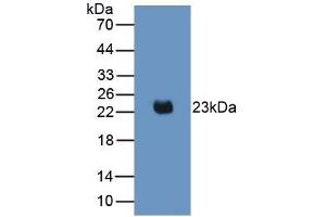 Detection of Recombinant IL2, Mouse using Monoclonal Antibody to Interleukin 2 (IL2) (IL-2 抗体  (AA 10-169))