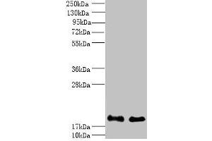 Western blot All lanes: PPP3R1 antibody at 1 μg/mL Lane 1: K562 whole cell lysate Lane 2: Hela whole cell lysate Secondary Goat polyclonal to rabbit IgG at 1/10000 dilution Predicted band size: 20 kDa Observed band size: 20 kDa (PPP3R1 抗体  (AA 11-170))