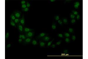 Immunofluorescence of monoclonal antibody to STK38 on HeLa cell. (STK38 抗体  (AA 365-465))