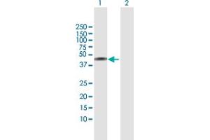 Western Blot analysis of NSDHL expression in transfected 293T cell line by NSDHL MaxPab polyclonal antibody. (NSDHL 抗体  (AA 1-373))