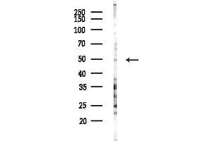 anti-Caspase Recruitment Domain Family, Member 8 (CARD8) antibody
