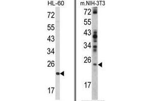 (LEFT) Western blot analysis of RAN Antibody (N-term) in HL-60 cell line lysates (35ug/lane). (RAN 抗体  (N-Term))