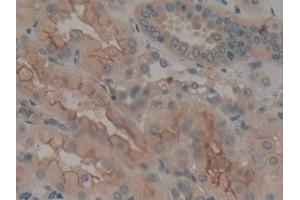 Immunohistochemistry (IHC) image for anti-Calumenin (CALU) (AA 20-315) antibody (ABIN7434203)