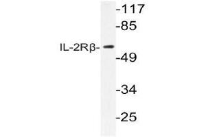 Western blot (WB) analysis of IL-2Rbeta antibody in extracts from RAW264. (IL2 Receptor beta 抗体)