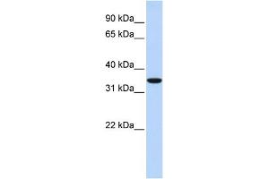 WB Suggested Anti-MARCH1 Antibody Titration:  0. (MARCH1 抗体  (N-Term))