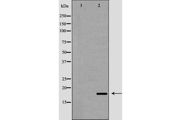 LCN6 抗体  (Internal Region)