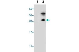 Western blot analysis of KLK7 (arrow) using KLK7 polyclonal antibody . (Kallikrein 7 抗体  (C-Term))