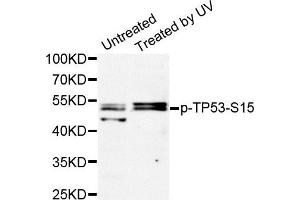 Western Blotting (WB) image for anti-Tumor Protein P53 (TP53) (pSer15) antibody (ABIN1870674) (p53 抗体  (pSer15))