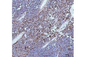 IHC analysis of IL22 using anti-IL22 antibody (ABIN5518929). (IL-22 抗体  (AA 34-179))