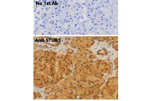 Immunohistochemistry (IHC) image for anti-STIP1 Homology and U-Box Containing Protein 1 (STUB1) antibody (ABIN6254206) (STUB1 抗体)
