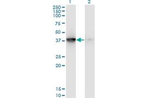 Western Blot analysis of MAPKAPK3 expression in transfected 293T cell line by MAPKAPK3 monoclonal antibody (M01), clone 3F4. (MAPKAP Kinase 3 抗体  (AA 272-382))