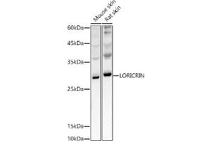 Western blot analysis of extracts of various cell lines, using LORICRIN antibody (ABIN7268295) at 1:1000 dilution. (LOR 抗体)