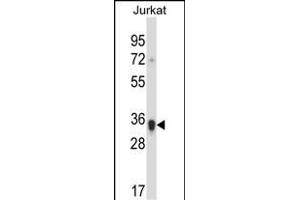 KIR2DS1 Antibody (Center) (ABIN657823 and ABIN2846790) western blot analysis in Jurkat cell line lysates (35 μg/lane).