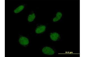 Immunofluorescence of  purified  MaxPab antibody to RNF113A on HeLa cell. (RNF113A 抗体  (AA 1-343))