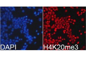 Immunofluorescence analysis of 293T cell using H4K20me3 antibody.