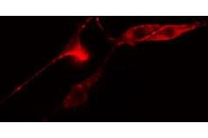 ABIN6274748 staining COLO205 cells by IF/ICC. (RPS12 抗体  (C-Term))