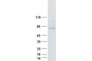 Validation with Western Blot