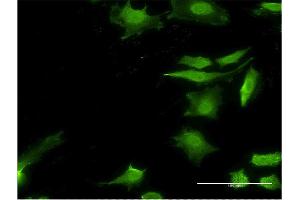 Immunofluorescence of monoclonal antibody to STIP1 on HeLa cell. (STIP1 抗体  (AA 1-543))