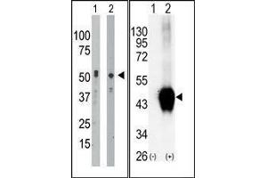 (LEFT)The anti-BCKDK Pab is used in Western blot to detect BCKDK in mouse intestine tissue lysate (Lane 1) and Hela cell lysate (Lane 2).