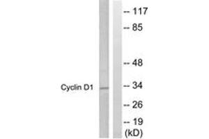 Western blot analysis of extracts from Jurkat cells, treated with EGF 200ng/ml 30', using Cyclin D1 (Ab-286) Antibody. (Cyclin D1 抗体  (AA 246-295))