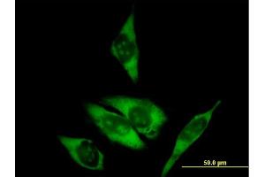 Immunofluorescence of purified MaxPab antibody to RPL29 on HeLa cell. (RPL29 抗体  (AA 1-159))