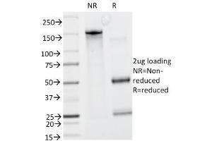 SDS-PAGE Analysis Purified Caldesmon Mouse Monoclonal Antibody (CALD1/820). (Caldesmon 抗体)