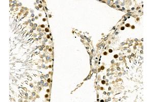 ABIN6257335 and ABIN6274168 at 1/100 staining Rat testis tissue by IHC-P. (MYF5 抗体  (N-Term))