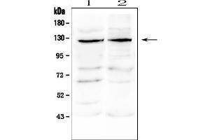 Western blot analysis of JAK3 using anti-JAK3 antibody (ABIN6719493).