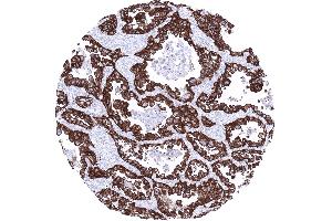 Immunohistochemistry (IHC) image for anti-Epithelial Cell Adhesion Molecule (EPCAM) (AA 100-224), (Extracellular Domain) antibody (ABIN7477469)