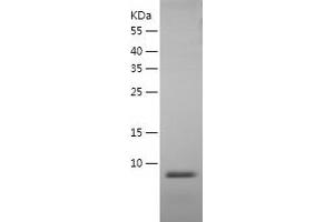 Granulin Protein (GRN) (AA 364-430) (His tag)