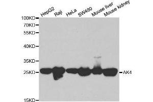 Western blot analysis of extracts of various cell lines, using AK4 antibody. (AK4 抗体  (AA 1-223))