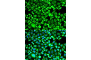 Immunofluorescence analysis of A549 cells using PSMB8 antibody. (PSMB8 抗体)