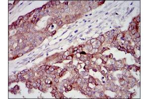 Immunohistochemistry (IHC) image for anti-Insulin-Like Growth Factor 2 (IGF2) (AA 25-180) antibody (ABIN1846026) (IGF2 抗体  (AA 25-180))
