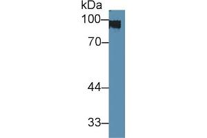 Detection of CK1 in Rat Skin lysate using Polyclonal Antibody to Cytokeratin 1 (CK1) (Cytokeratin 1 抗体  (AA 189-497))