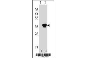 Western blot analysis of AKR1A1 using rabbit polyclonal AKR1A1 Antibody using 293 cell lysates (2 ug/lane) either nontransfected (Lane 1) or transiently transfected (Lane 2) with the AKR1A1 gene. (AKR1A1 抗体  (C-Term))