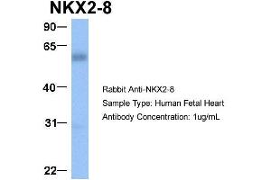 Host:  Rabbit  Target Name:  NKX2-8  Sample Type:  Human Fetal Heart  Antibody Dilution:  1. (NKX2-8 抗体  (C-Term))