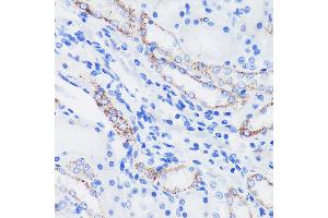 Immunohistochemistry of paraffin-embedded Rat kidney using EPN1 Rabbit pAb (ABIN7267000) at dilution of 1:100 (40x lens). (Epsin 1 抗体  (AA 130-180))