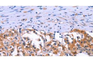 Immunohistochemistry (IHC) image for anti-Anoctamin 1, Calcium Activated Chloride Channel (ANO1) antibody (ABIN7002623) (ANO1 抗体)