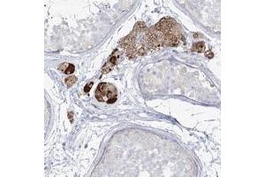 Immunohistochemical staining of human testis with ZNF843 polyclonal antibody  shows strong cytoplasmic positivity in Leydig cells. (ZNF843 抗体)