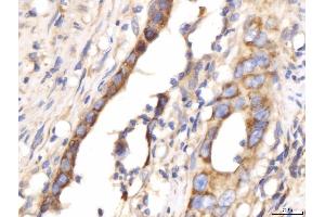 IHC analysis of PDE4DIP using anti-PDE4DIP antibody (ABIN7602691). (PDE4DIP 抗体  (AA 96-1254))