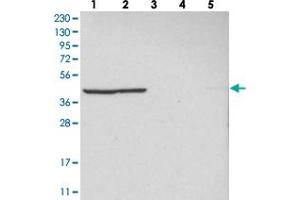 Western blot analysis of Lane 1: RT-4, Lane 2: U-251 MG, Lane 3: Human Plasma, Lane 4: Liver, Lane 5: Tonsil with MRPL37 polyclonal antibody . (MRPL37 抗体)