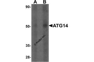 Western Blotting (WB) image for anti-ATG14 Autophagy Related 14 (ATG14) antibody (ABIN1077377) (ATG14 抗体)