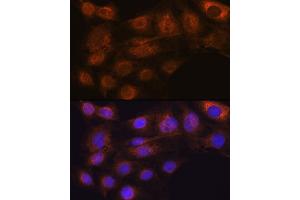 Immunofluorescence analysis of C6 cells using  Rabbit mAb (ABIN7265485) at dilution of 1:100 (40x lens). (ARF6 抗体)